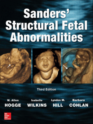 Structural Fetal Abnormalities