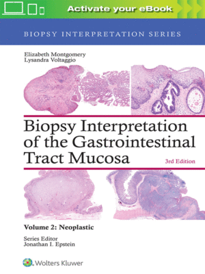 Biopsy Interpretation of the Gastrointestinal Tract Mucosa-Neoplastic