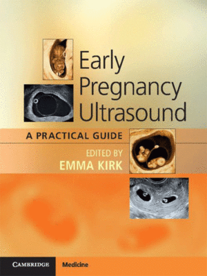 Early Pregnancy Ultrasound