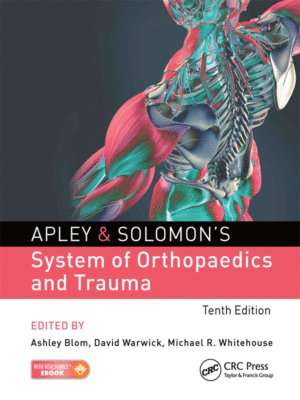 Apley & Solomon’s System of Orthopaedics and Trauma