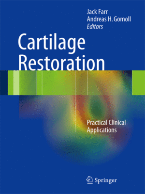 Cartilage-Restoration-web-offer
