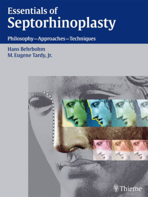 Essentials-of-Septorhinoplasty-web-offer
