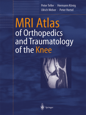 MRI-Atlas-of-Orthopedics-and-Traumatology-of-the-Knee-web-offer