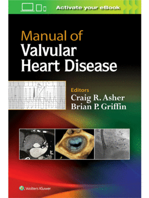 Manual of Valvular Heart Disease