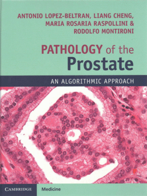 Pathology of the Prostate