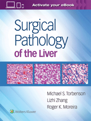 Surgical Pathology of the Liver