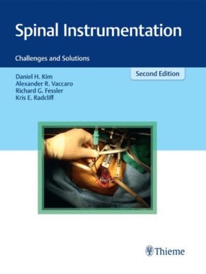 Spinal Instrumentation: Challenges and Solutions, 2nd Edition