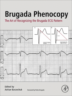 Brugada Phenocopy
