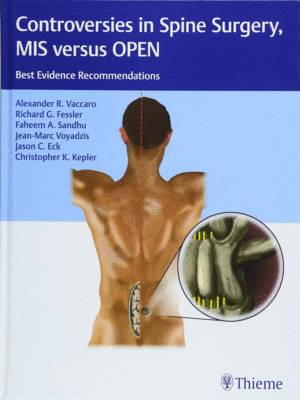 Controversies in Spine Surgery, MIS versus OPEN