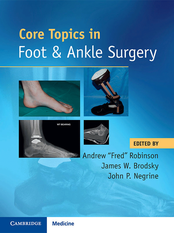 Core Topics in Foot and Ankle Surgery Core Topics in Foot and Ankle Surgery