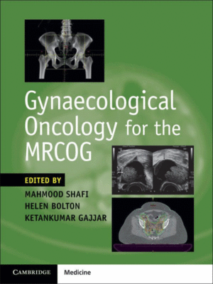 Gynaecological Oncology for the MRCOG