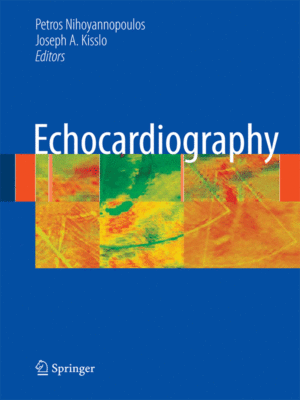 Echocardiography by Nihoyannopoulos
