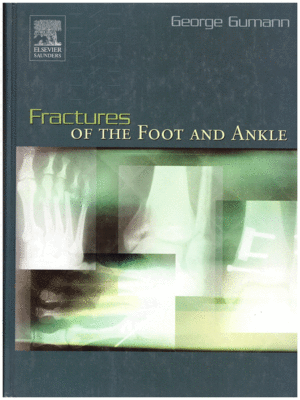 Fractures of the Foot and Ankle