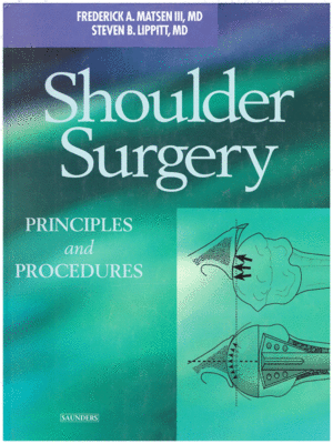Shoulder Surgery by Matsen