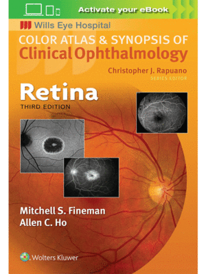 Color Atlas and Synopsis of Clinical Ophthalmology: Retina