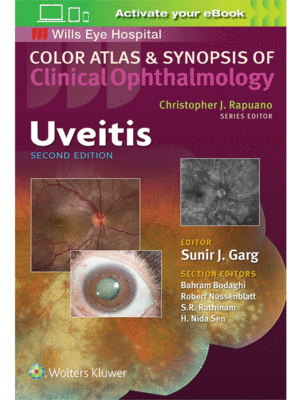 Color Atlas and Synopsis of Clinical Ophthalmology: Uveitis