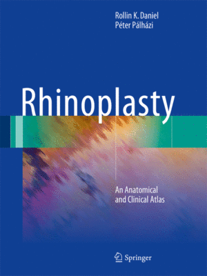 Rhinoplasty by Daniel