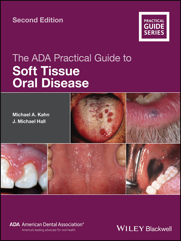 The ADA Practical Guide to Soft Tissue Oral Disease The ADA Practical Guide to Soft Tissue Oral Disease