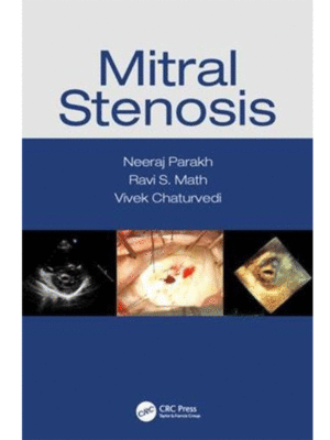 Mitral Stenosis