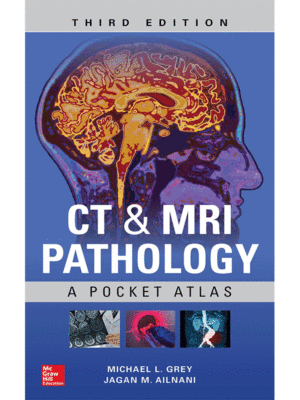 CT & MRI Pathology