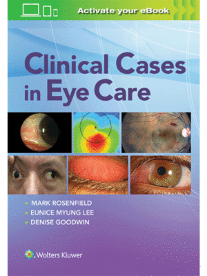 Clinical Cases in Eye Care by Rosenfield