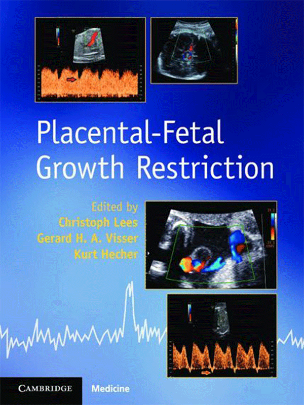 Placental-Fetal Growth Restriction Placental-Fetal Growth Restriction