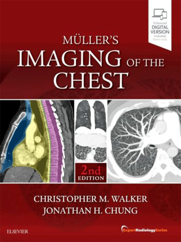 Müller's Imaging of the Chest, 2nd Edition (Expert Radiology Series)