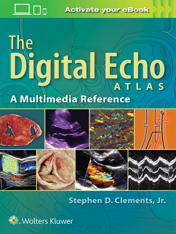 The Digital Echo Atlas by Clements: A Multimedia Reference