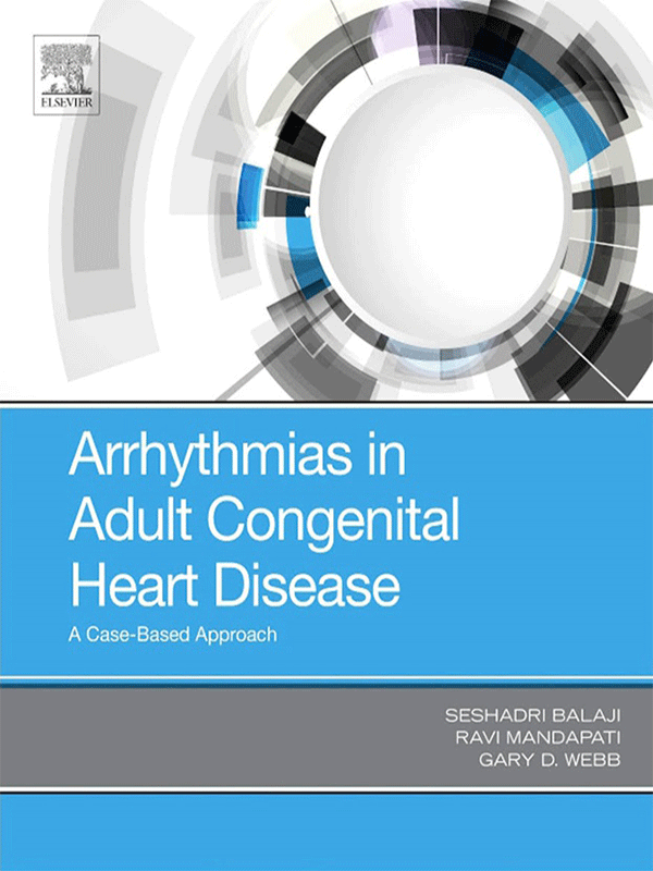 Arrhythmias in Adult Congenital Heart Disease: A Case-Based Approach