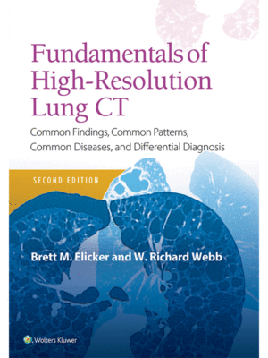 Fundamentals of High-Resolution Lung CT by Elicker & Webb: Common Findings, Common Patterns, Common Diseases and Differential Diagnosis, 2nd Edition