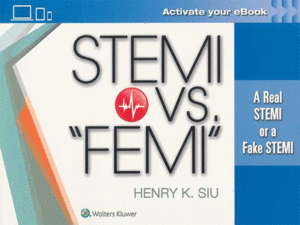 STEMI vs. “FEMI”: A Real STEMI or a Fake STEMI