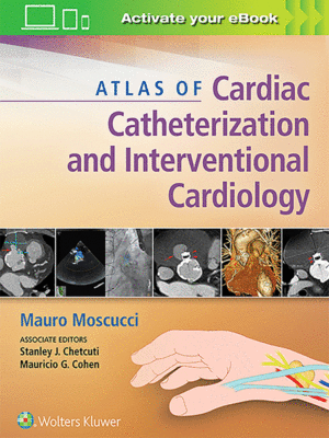 Atlas of Cardiac Catheterization and Interventional Cardiology by Moscucci