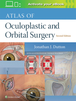 Atlas of Oculoplastic and Orbital Surgery by Dutton, 2nd Edition