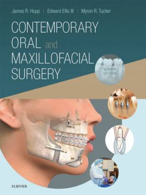 Contemporary Oral and Maxillofacial Surgery by Hupp, 7th Edition