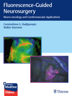 Fluorescence-Guided Neurosurgery by Hadjipanayis