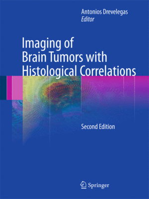Imaging of Brain Tumors with Histological Correlations by Drevelegas, 2nd Edition