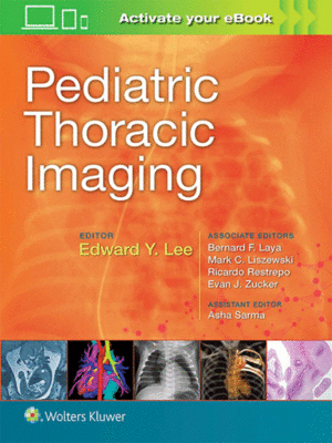 Pediatric Thoracic Imaging by Lee