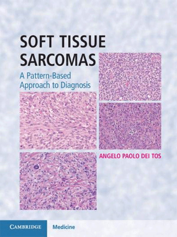 Soft Tissue Sarcomas: A Pattern-Based Approach to Diagnosis
