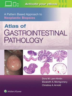 Atlas of Gastrointestinal Pathology by Montgomery: A Pattern Based Approach to Neoplastic Biopsies