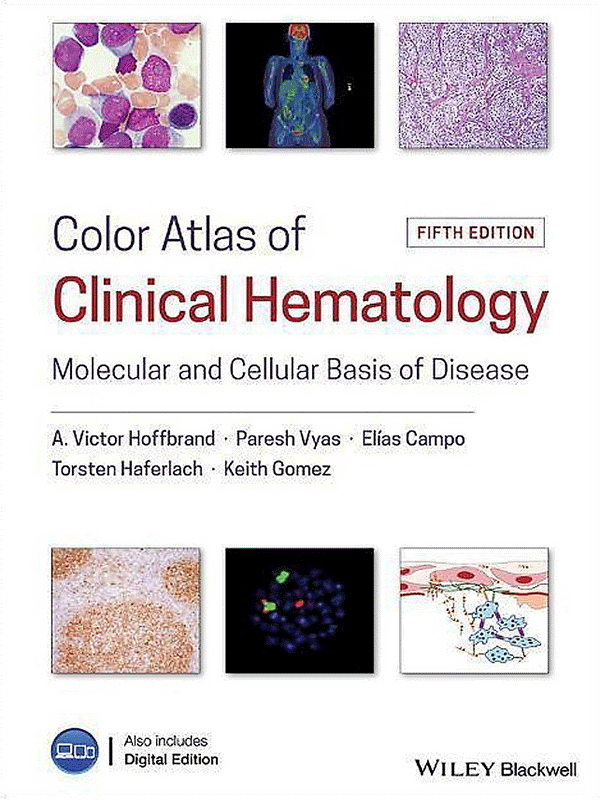 Color Atlas of Clinical Hematology by Hoffbrand: Molecular and Cellular Basis of Disease, 5th Edition Color Atlas of Clinical Hematology by Hoffbrand: Molecular and Cellular Basis of Disease, 5th Edition