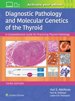 Diagnostic Pathology and Molecular Genetics of the Thyroid by Nikiforov: A Comprehensive Guide for Practicing Thyroid Pathology, 3rd Edition