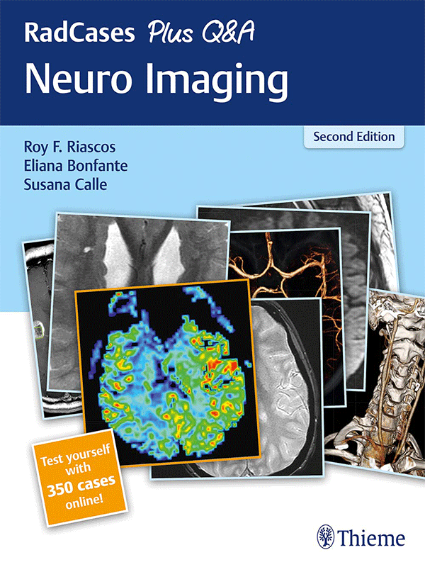 RadCases Plus Q&A: NeuroImaging, 2nd Edition