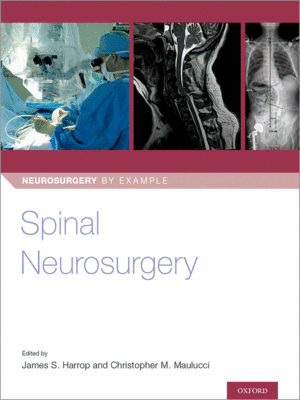 Spinal Neurosurgery by Harrop