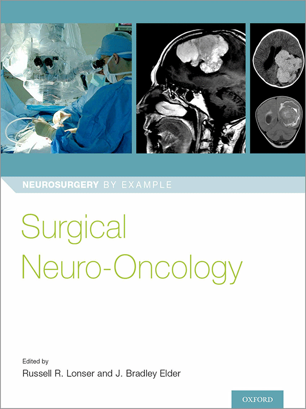 Surgical Neuro-Oncology by Lonser Surgical Neuro-Oncology by Lonser