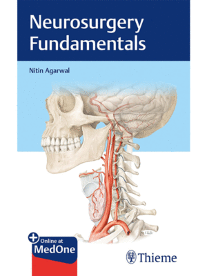 Neurosurgery Fundamentals by Agarwal
