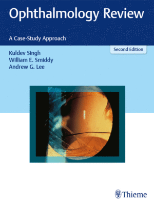 Ophthalmology Review by Singh: A Case-Study Approach, 2nd Edition