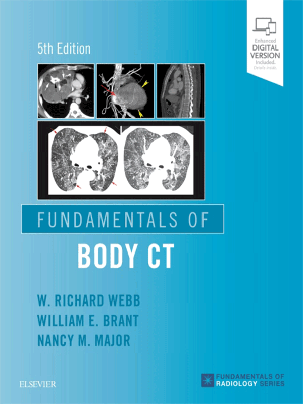 Fundamentals of Body CT by Webb, 5th Edition