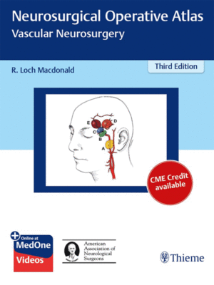 Neurosurgical Operative Atlas by Macdonald: Vascular Neurosurgery, 3rd Edition