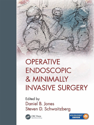Operative Endoscopic and Minimally Invasive Surgery by Jones