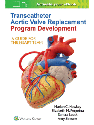 Transcatheter Aortic Valve Replacement Program Development